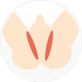 Vライン脱毛
