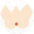Oライン脱毛