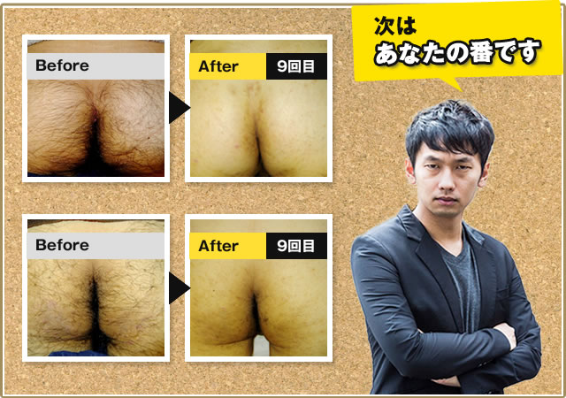 次はあながケツ毛を脱毛する番です