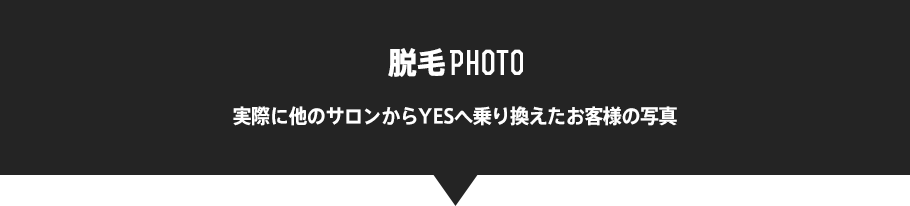 脱毛Photo 実際に他のサロンからYESへ乗り換えたお客様の写真